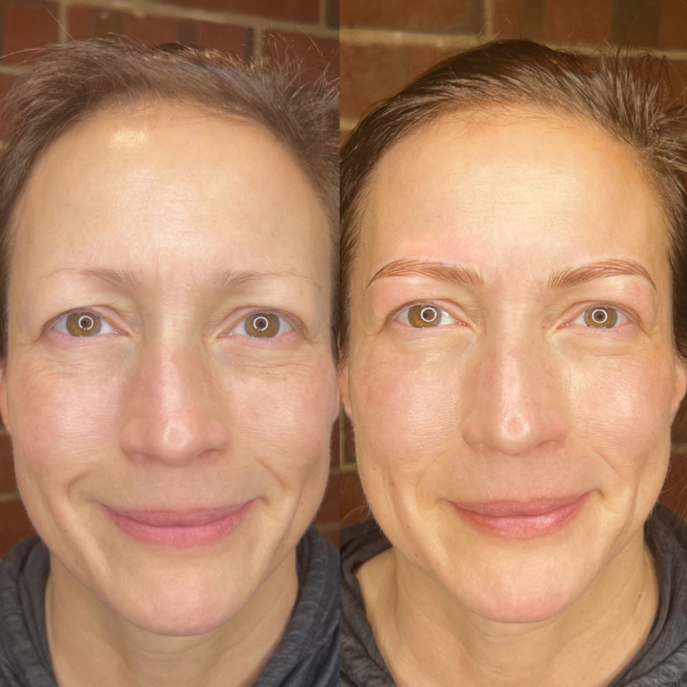 NANO-BROWS
